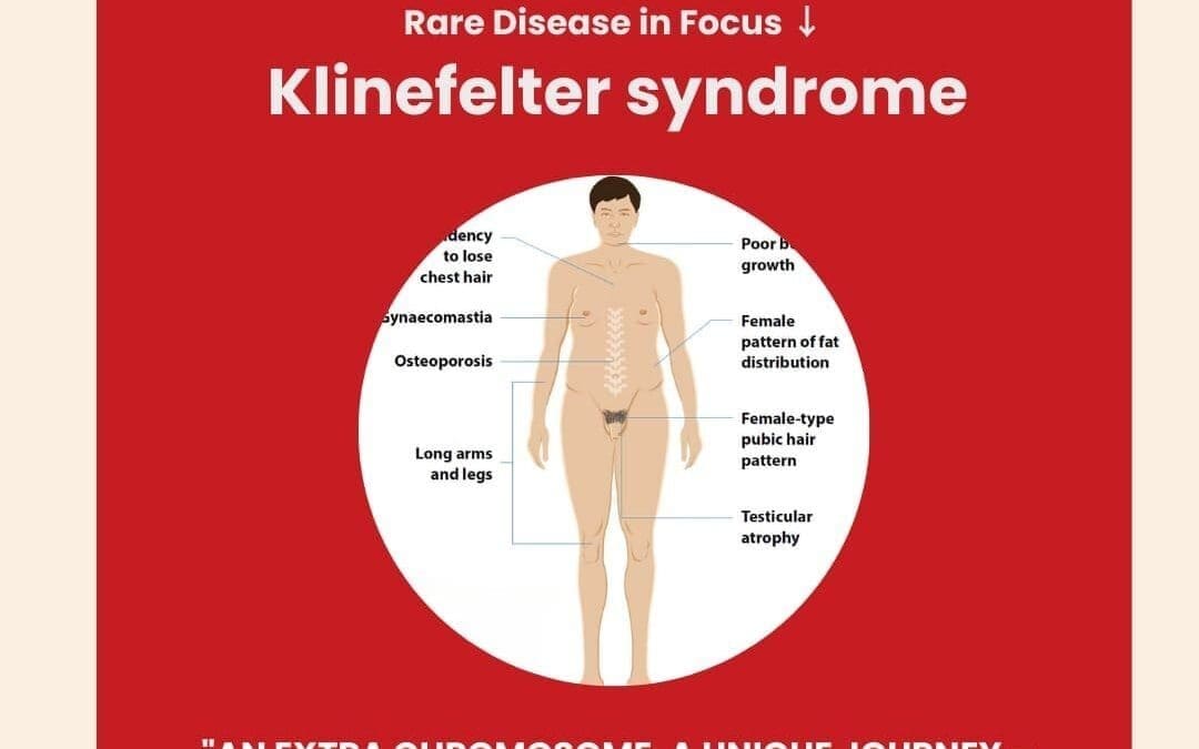 Day 24 of 28 Days, 28 Rare Diseases – Understanding Klinefelter Syndrome